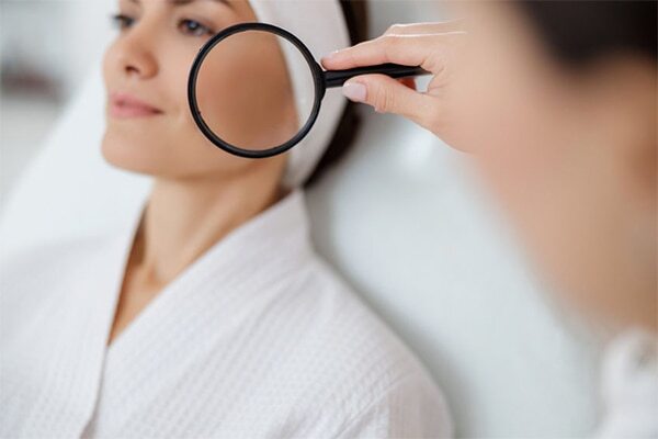 FAQs about pale skin