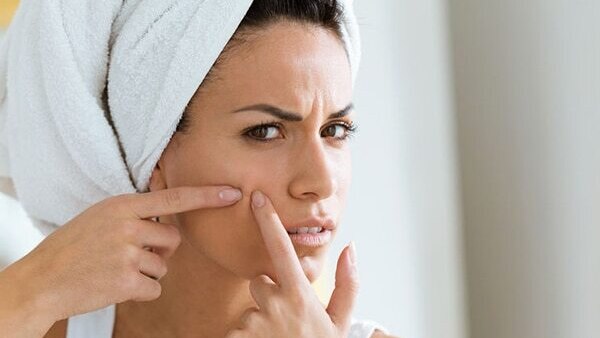 04. How to deal with blind pimples?