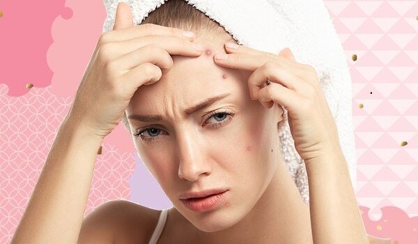 Expert Recommended Tips To Get Rid Of Pimples On The Forehead