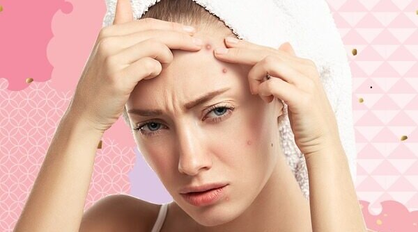Expert Recommended Tips To Get Rid Of Pimples On The Forehead