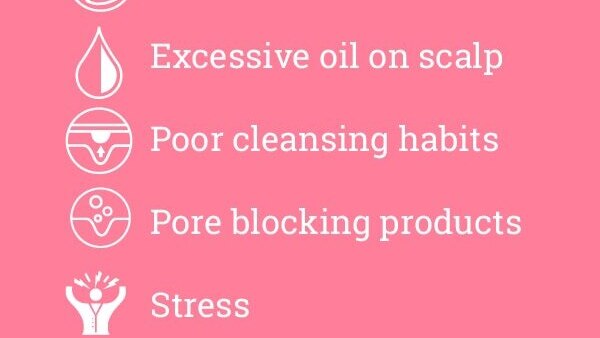 FAQs about pimples on forehead