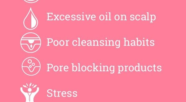 FAQs about pimples on forehead