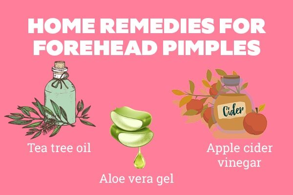 FAQs about pimples on forehead