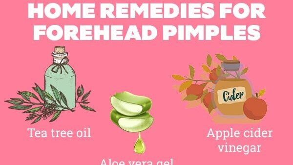 FAQs about pimples on forehead