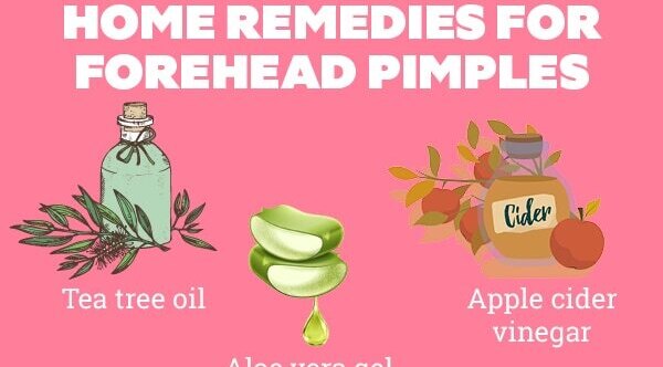 FAQs about pimples on forehead
