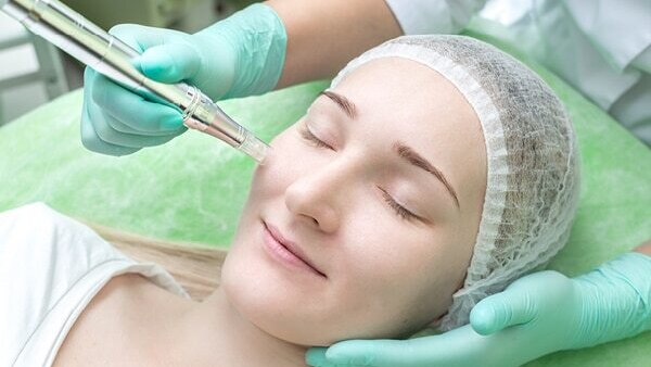 FAQs about dark circle treatment