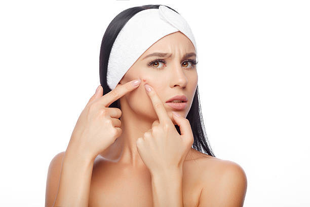 Tips On How To Get Rid Of A Pimple Before A Big Event