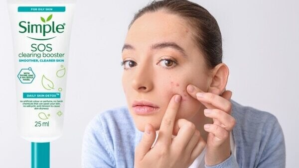 Tips on How to Get Rid of a Pimple Before a Big Event
