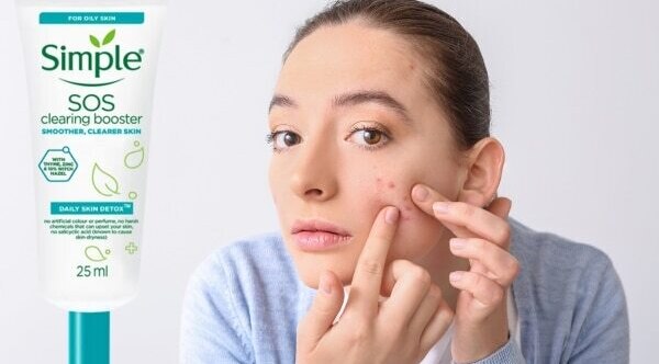 Tips on How to Get Rid of a Pimple Before a Big Event