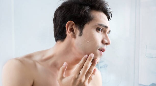 Factor in skin type