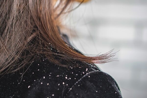 Black pepper helps to strengthen hair