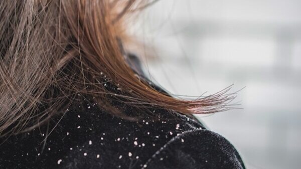 Black pepper helps to strengthen hair