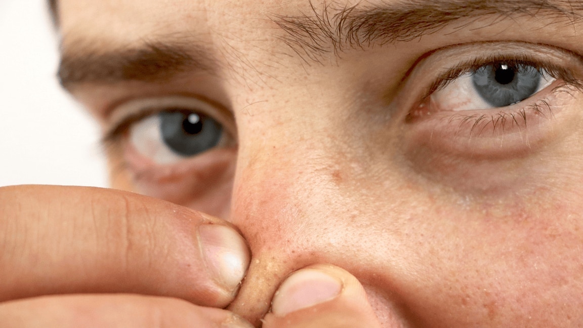 How to Remove Blackheads: Say Goodbye to Stubborn Spots With These Simple Steps
