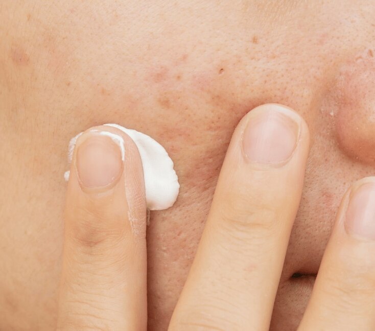 Image of Sun's Out, Dark Spots Begone: Your Go-to Sunscreen for Dark Spots