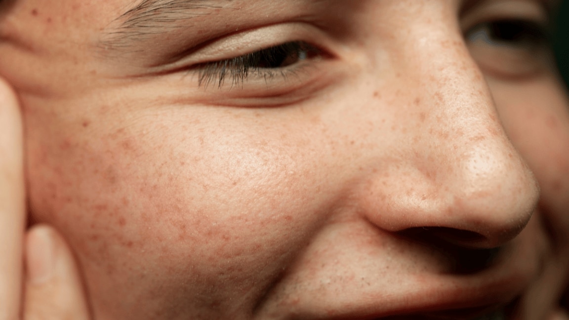 From Open to Invisible: Unlock the Secrets of How to Reduce Pores on Your Face
