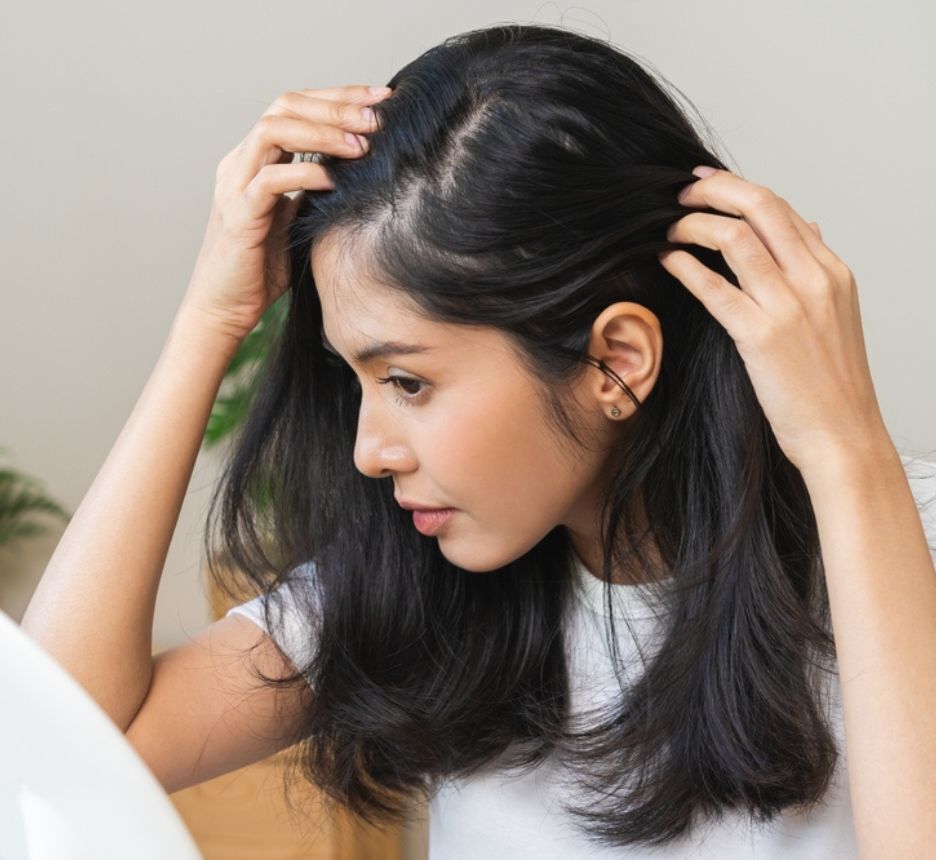 cấy tóc tác dụng phụ của việc cấy tóc cô gái đang quan sát da đầu qua gương soi