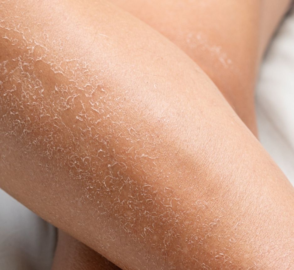 không nên tắm sau mấy giờ tác hại của tắm đêm gây nên các vấn đề về da