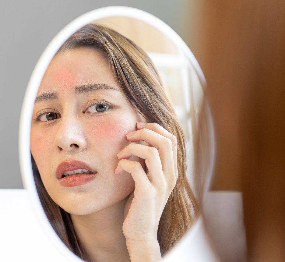 hàng rào bảo vệ da dấu hiệu cho thấy hàng rào bảo vệ da bị tổn thương cô gái đang soi gương với da mặt ửng đỏ