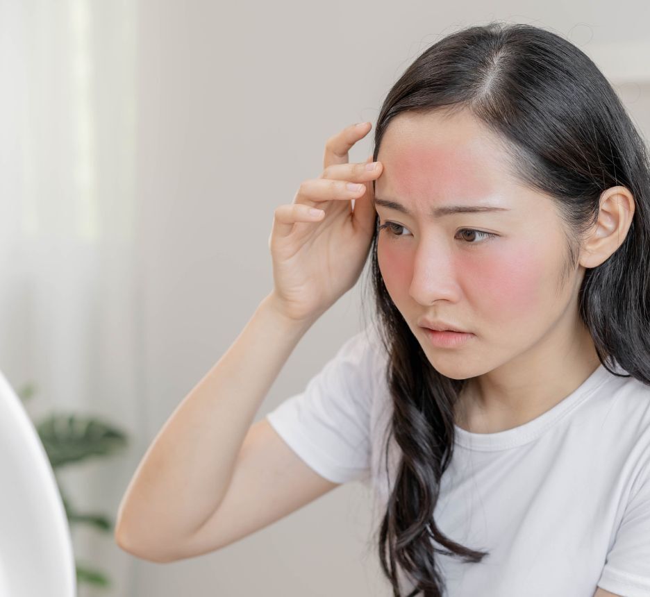 những loại kem chống nắng không nên dùng da bị kích ứng với kem chống nắng phải làm sao cô gái với da mặt bị đỏ đang soi gương