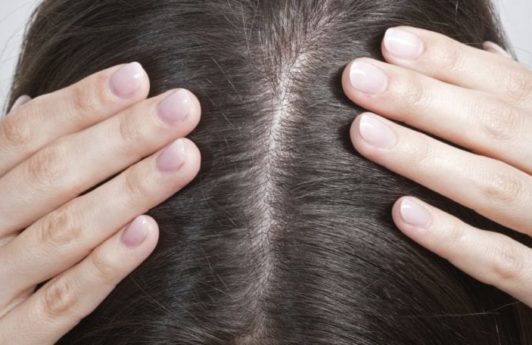 Itchy Scalp Causes and Treatments: How to Diagnose Itching and Dandruff