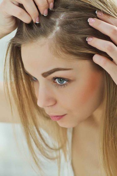 woman looking at her scalp in the mirror