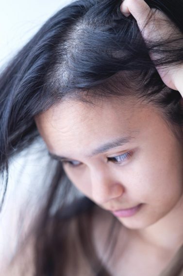 shedding: woman with long hair