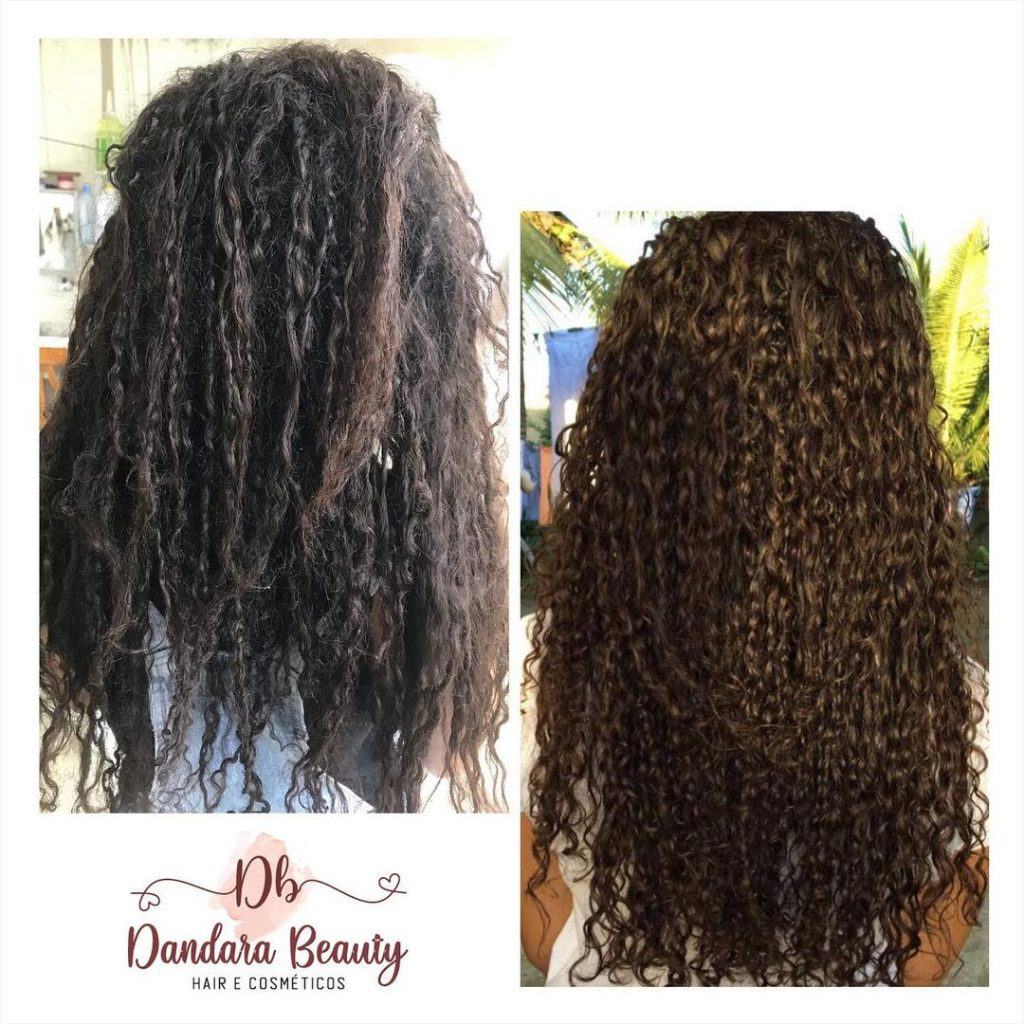 mulher com cabelo cacheado antes de depois de fazer botox