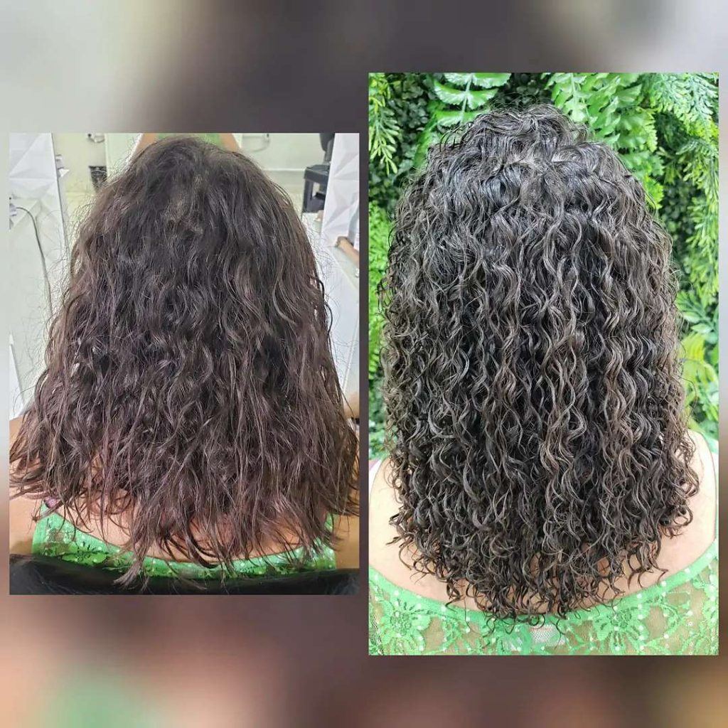 antes e depois do tratamento da desprogressiva