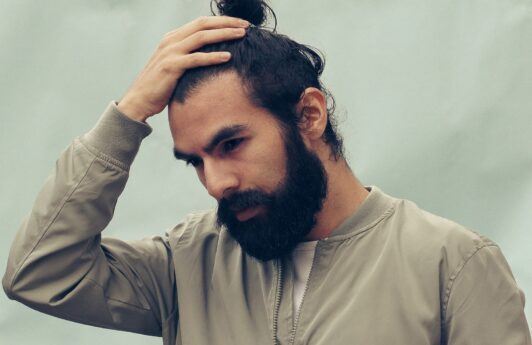 Como evitar caspa: 10 dicas fáceis para prevenir o problema!