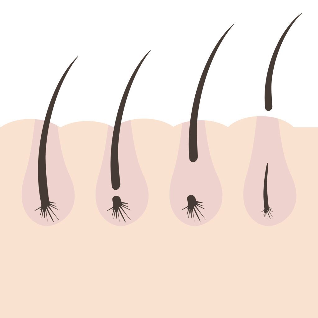 ilustração do ciclo de vida do cabelo