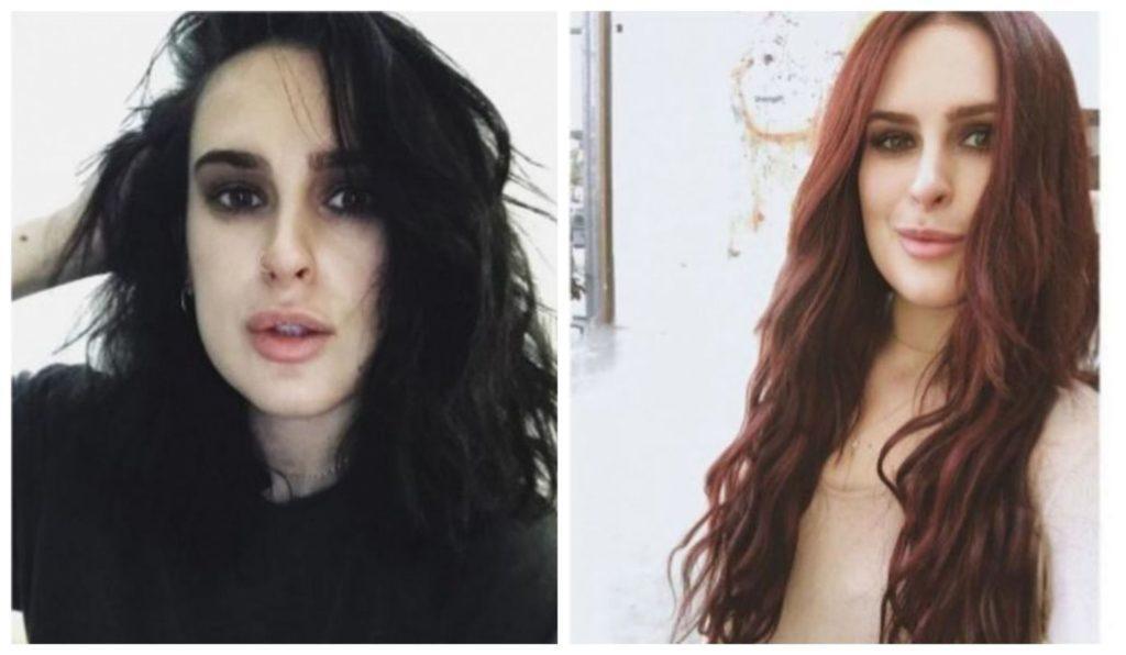 modelo de Antes e depois das celebridades