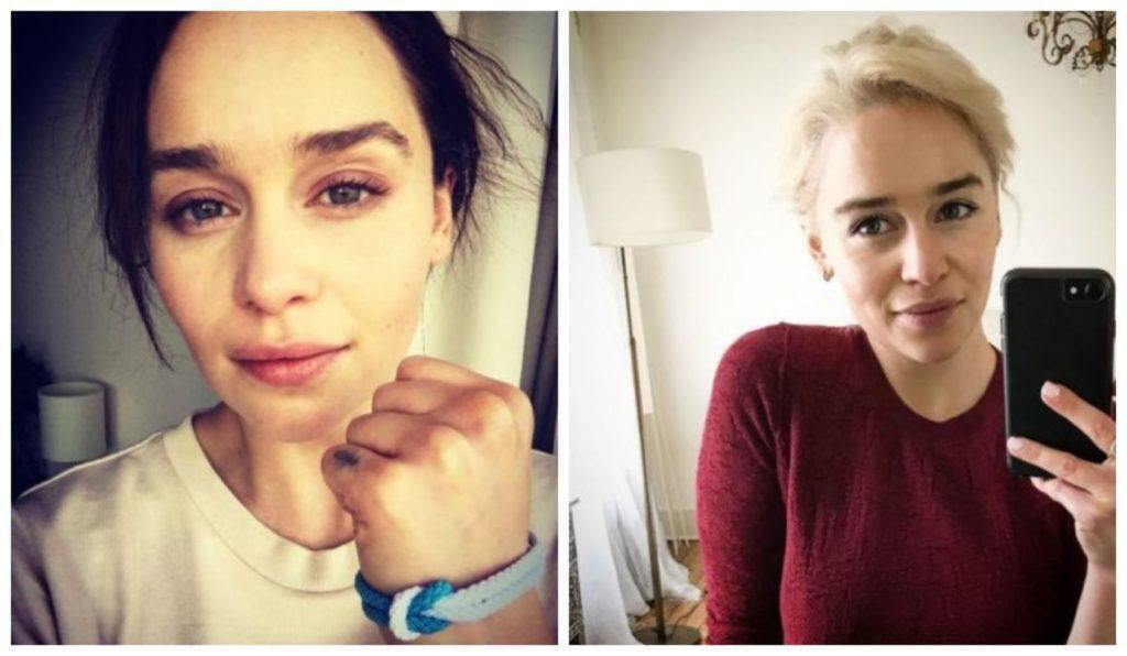 modelo de Antes e depois das celebridades