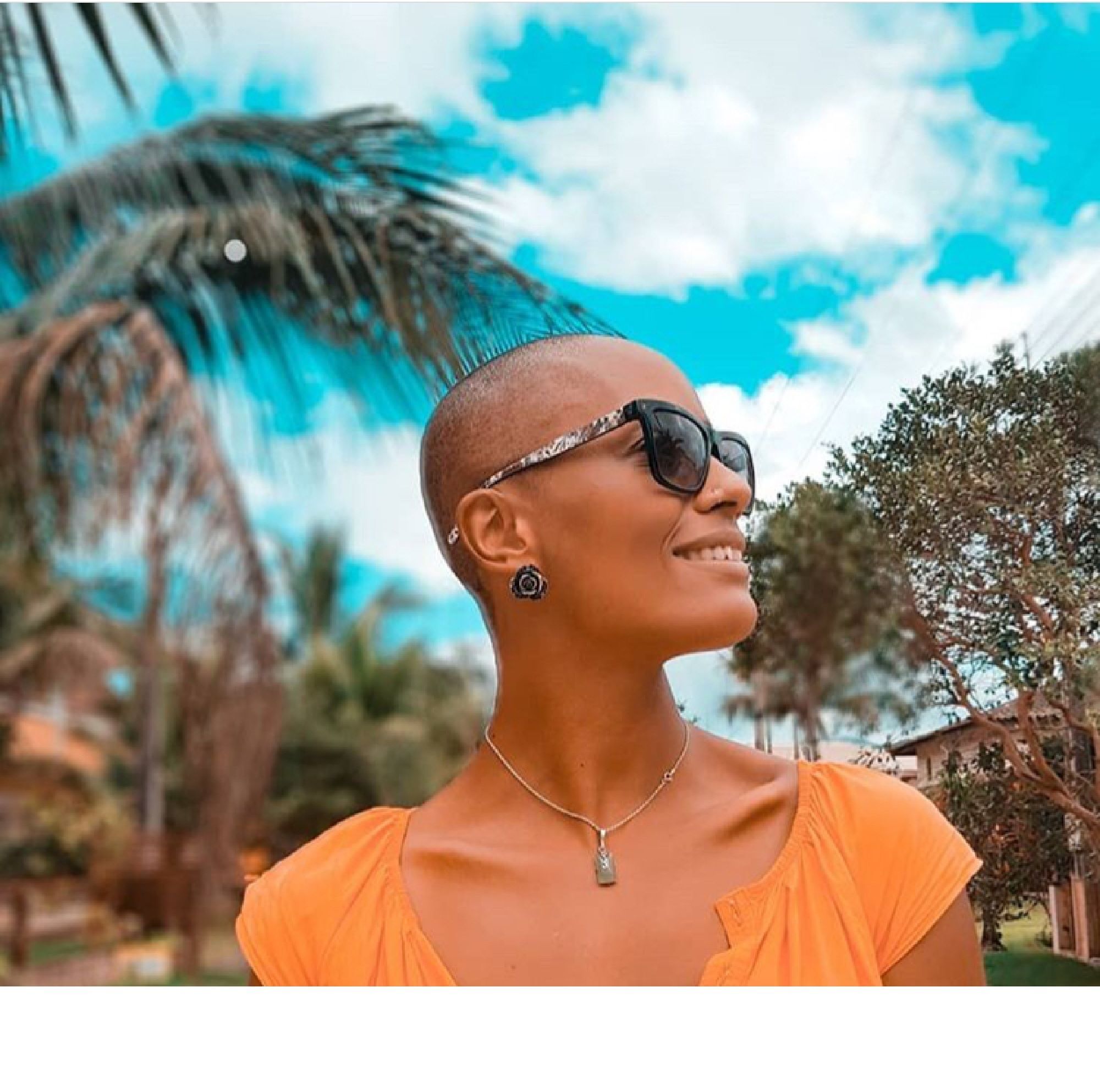 Cabeça careca feminina
