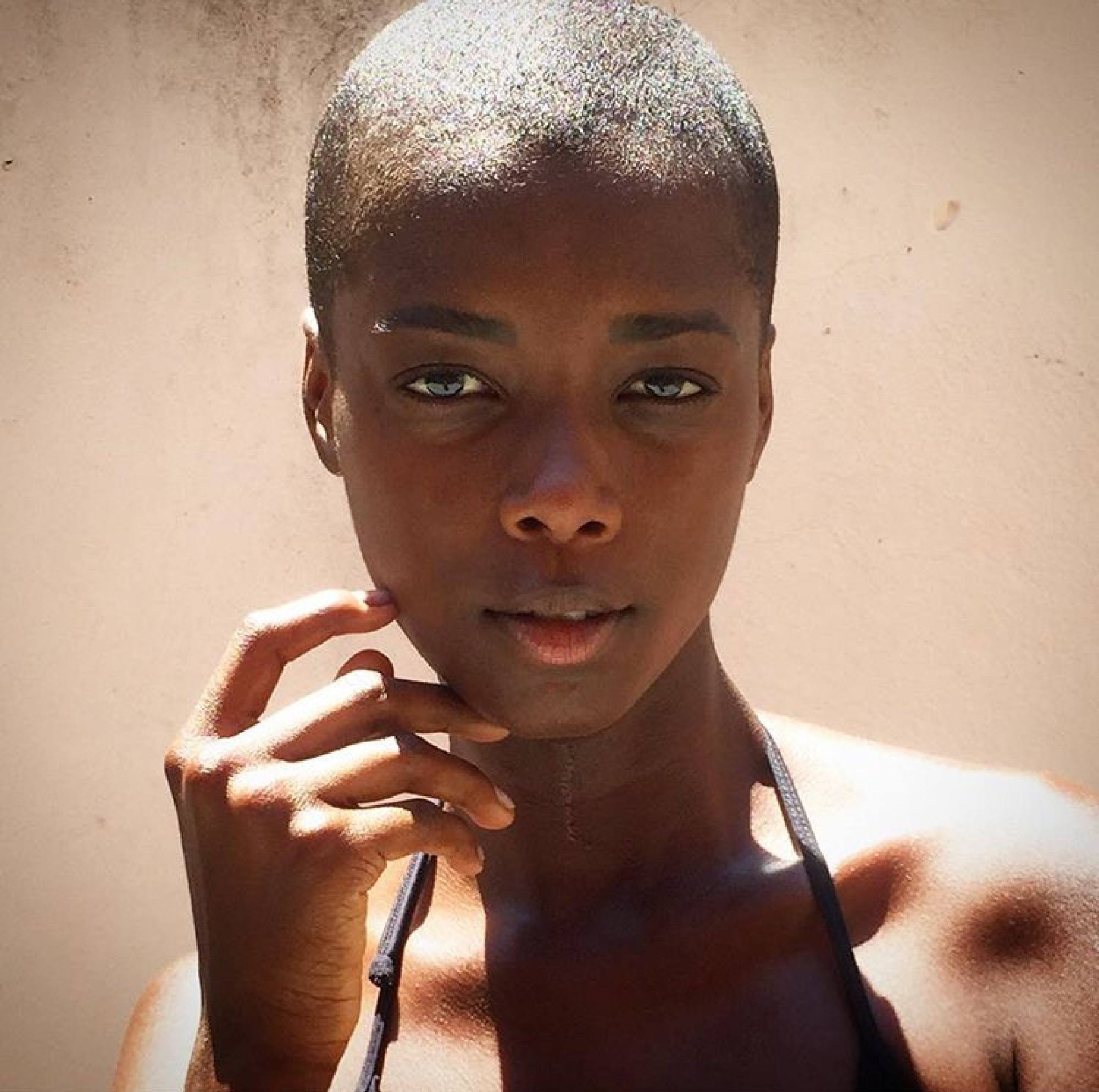 Cabeça careca feminina
