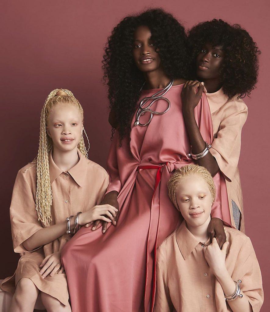 Mãe posa para foto rodeada pelas três filhas adolescentes. Elas são negras e duas das meninas são albinas