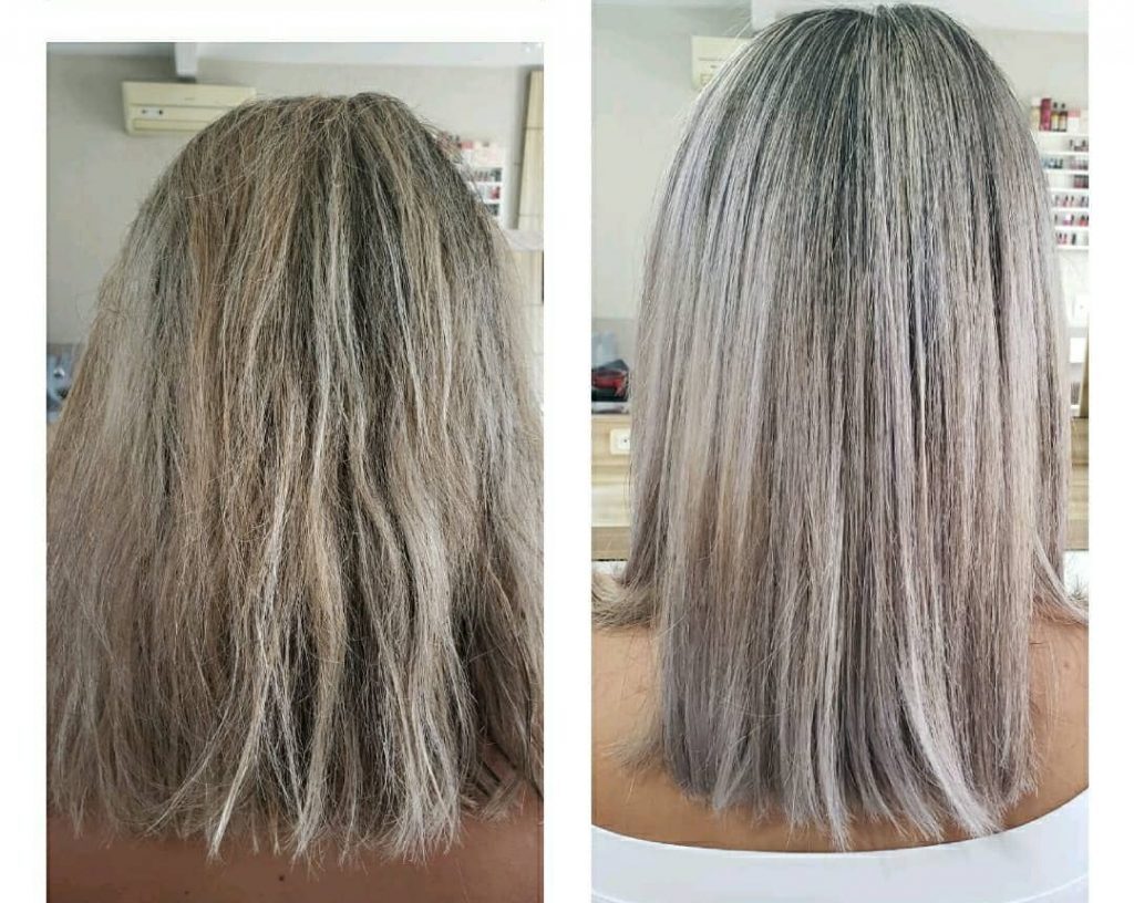 mulher com cabelo loiro antes e depois plástica dos fios