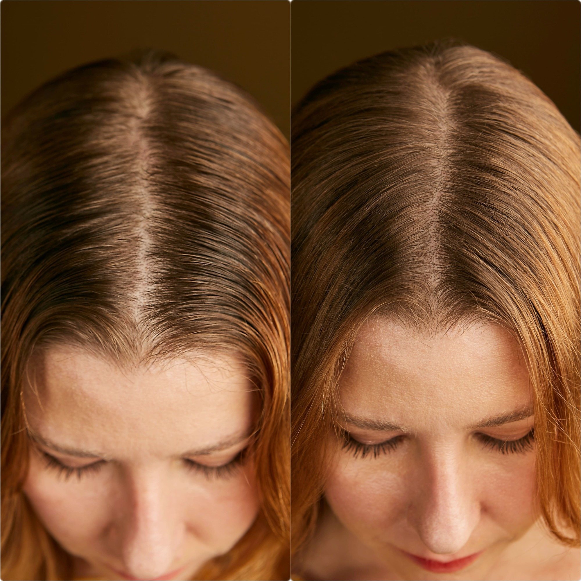 Couro cabeludo antes e depois do uso do shampoo seco