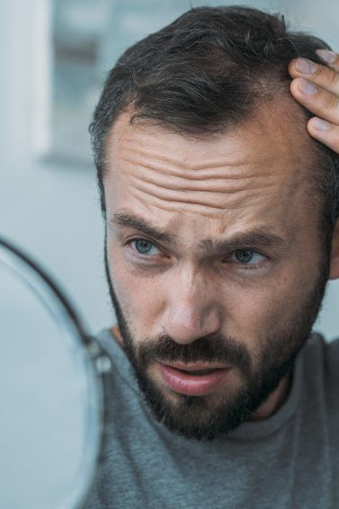 Homem para as entradas do seu cabelo pelo espelho