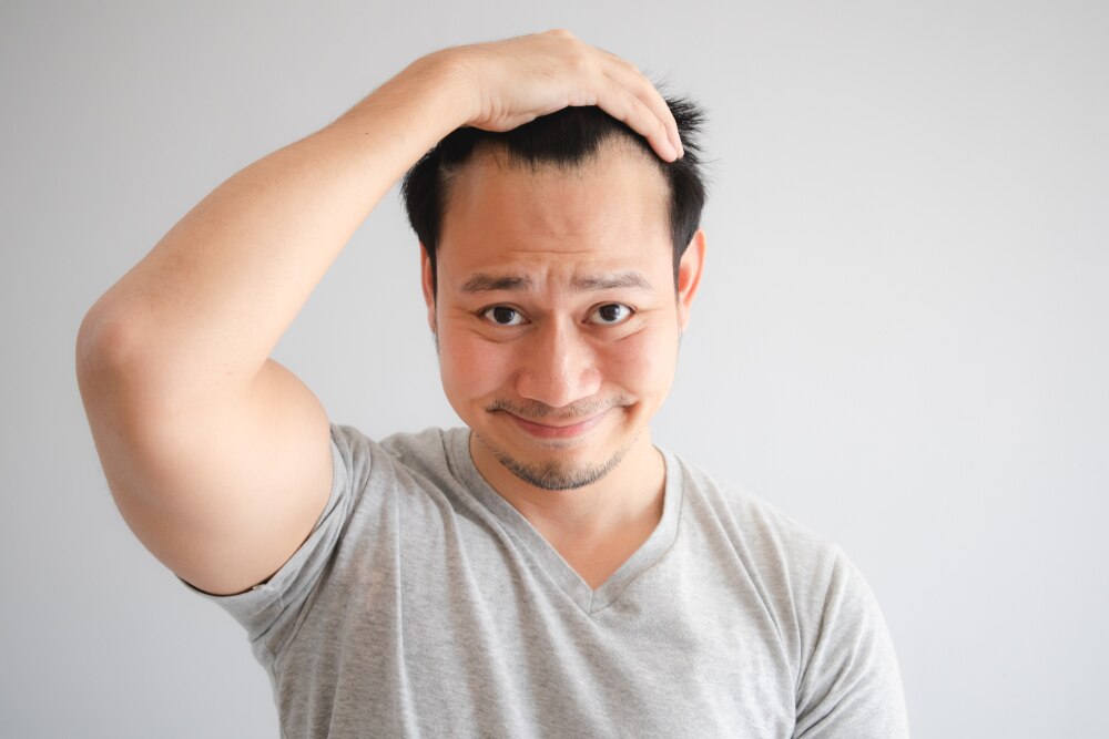 【ヘアメイク監修】前髪の薄毛が目立たないおしゃれな髪型5選！セットの仕方や日頃のケアも