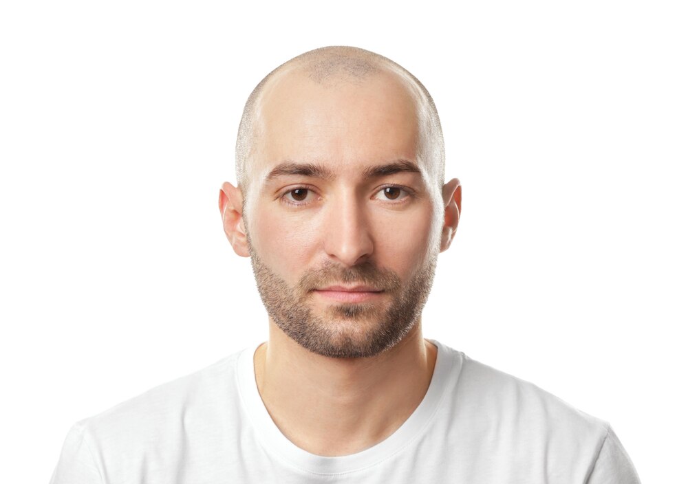 【ヘアメイク監修】前髪の薄毛が目立たないおしゃれな髪型5選！セットの仕方や日頃のケアも