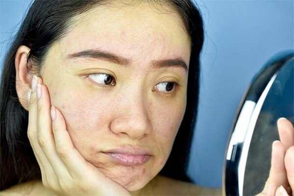 FAQs about pale skin