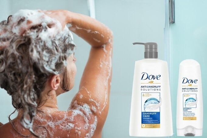 dandruff treatment faqs
