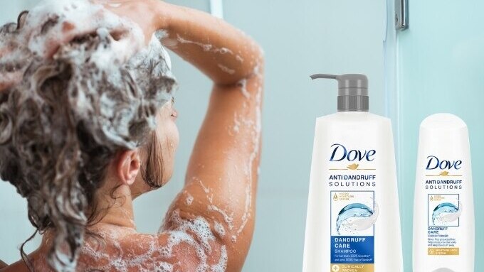 dandruff treatment faqs