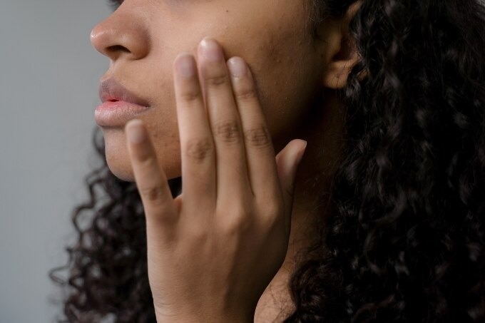FAQs about Clear Skin Trends and Tips