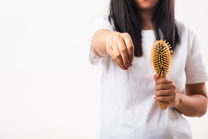 FAQs about Hair Loss