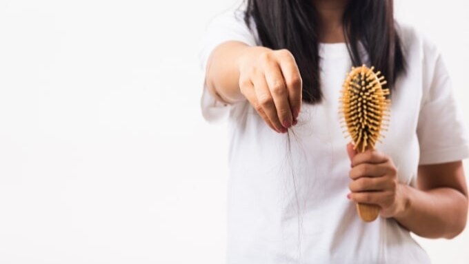 FAQs about Hair Loss