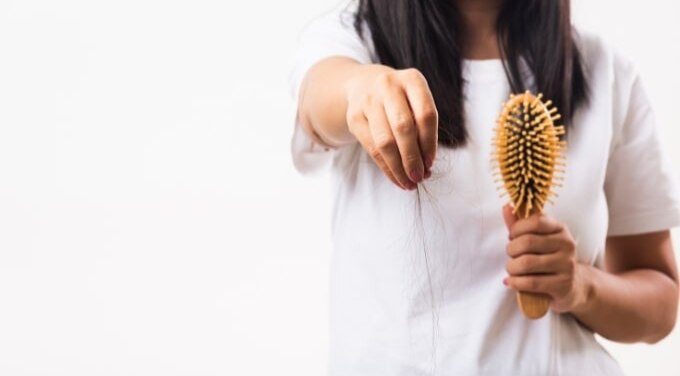 FAQs about Hair Loss