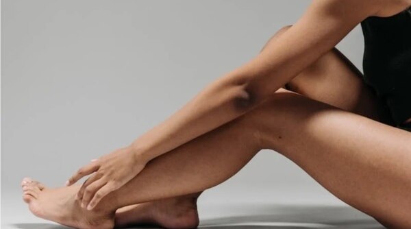 Why I Am Choosing To Embrace My Strawberry Legs