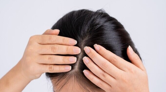 Spotting And Tackling Early Signs Of Hair Thinning