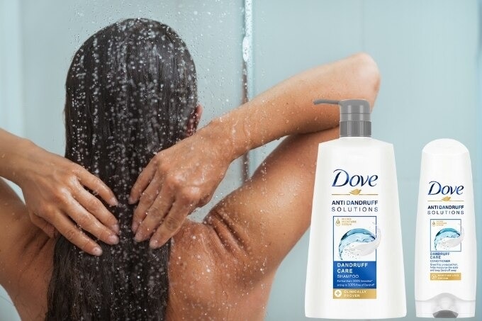 home-treatments-for-dandruff